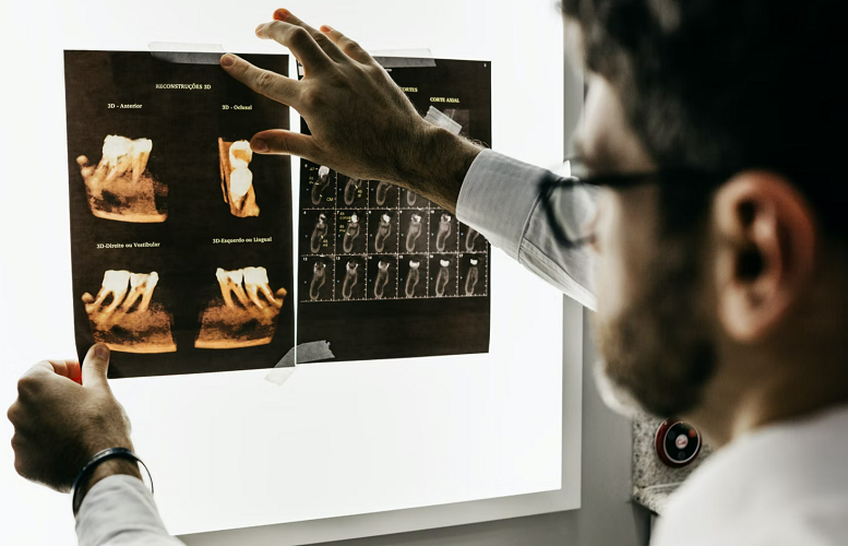 Dental Expert Examination